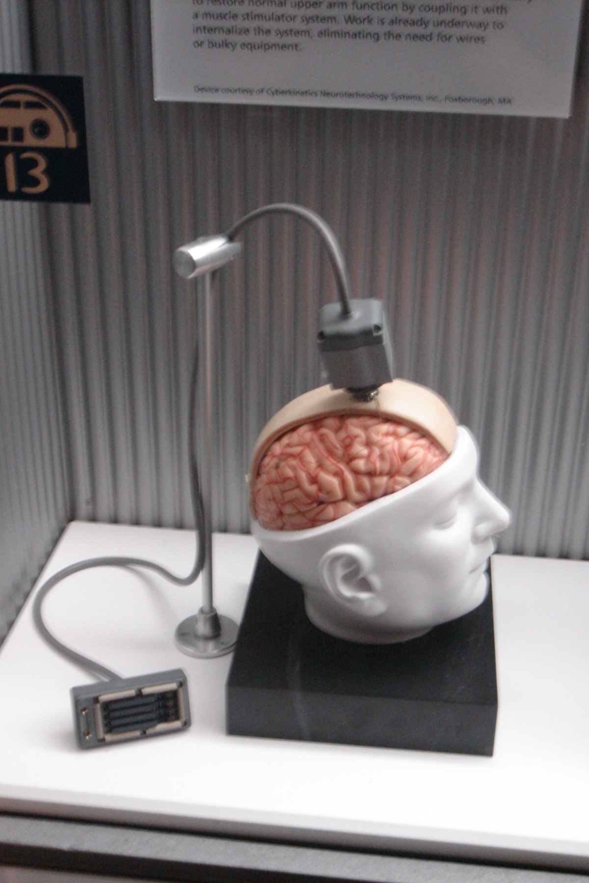 A demonstration model of the BrainGate brain-computer interface: a neural-signal connector mounted on a model head with an exposed brain, illustrating the type of intracortical implant used in the UC Davis ALS study.