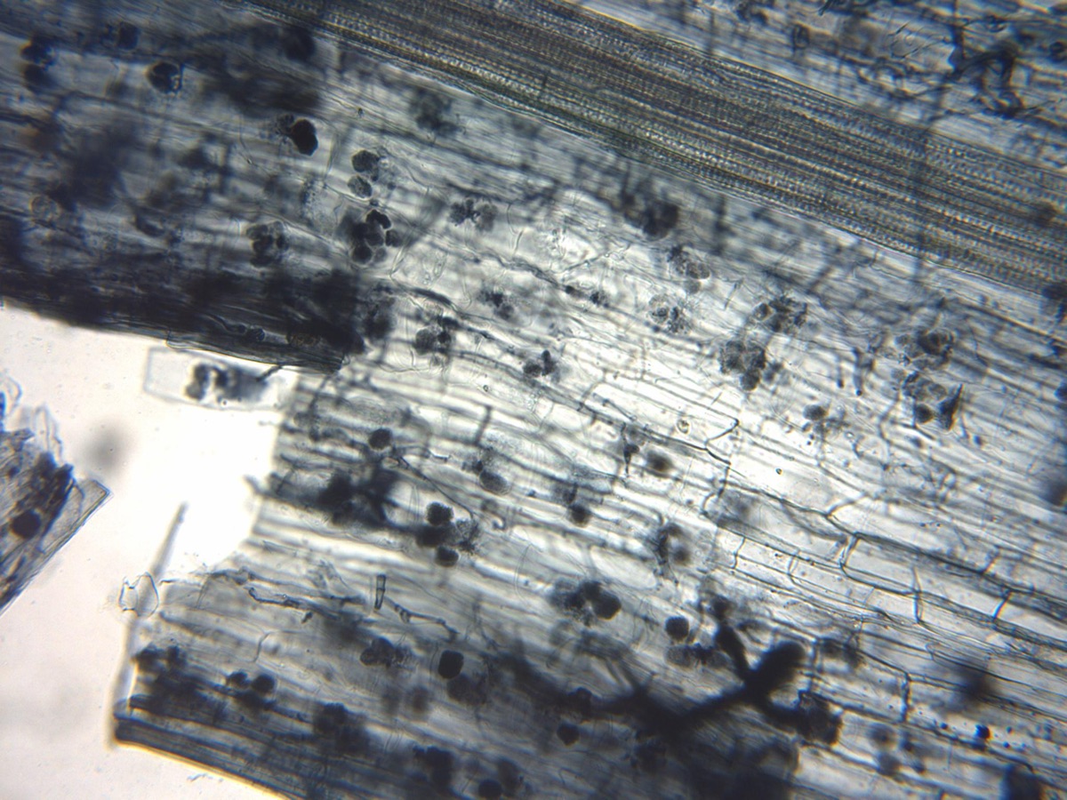 Microscope image of arbuscular mycorrhizal fungi - paired arbuscules inside flax root cortical cells - illustrating the underground fungal networks mapped globally for the first time in Science (June 2026)