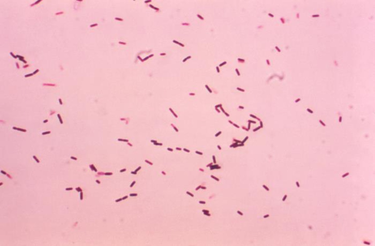 Micrograph of Bacillus subtilis, the soil bacterium engineered in the study to secrete plastic-degrading enzymes (representative CDC public-domain Gram stain, not the study’s own image).