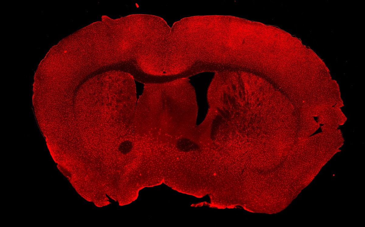Fluorescence microscopy image of a mouse brain coronal section with microglia, the brain's immune cells, labeled in red - illustrating research on reprogramming microglia to defend against Alzheimer's disease